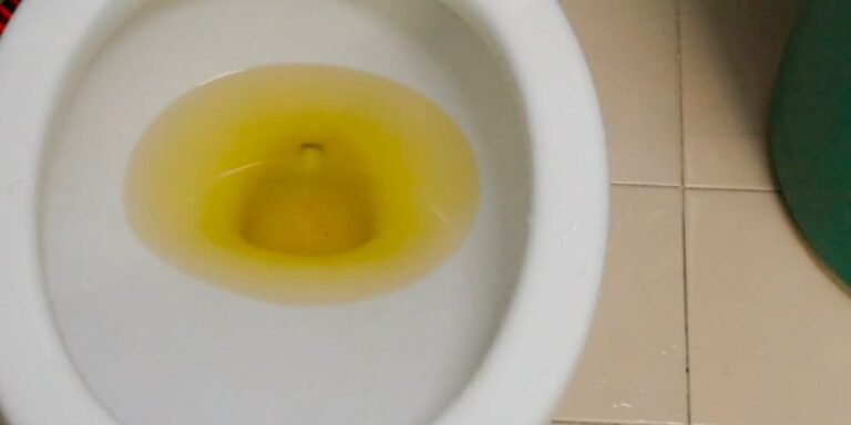 Why Is My Toilet Water Yellow? Reasons and Solutions